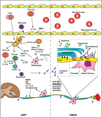 Intensive Care and Treatment of Severe Guillain–Barré Syndrome